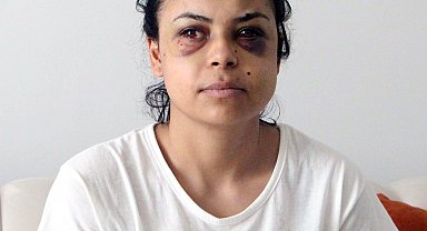 Düğünde tüfekle ateş açıldı, penceredeki Nazar gözlerinden yaralandı