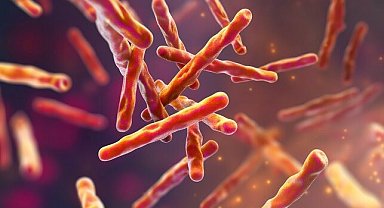 Florida'da tüberküloz vakası tespit edildi