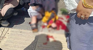 Husumetlilerin silahlı kavgasında yoldan geçen kadın bacağından vuruldu