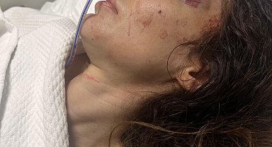 İstanbul - Beşiktaş'ta şikayet ettiği spor salonu sahibi tarafından bıçaklandı; hastanede yaşam mücadelesi veriyor