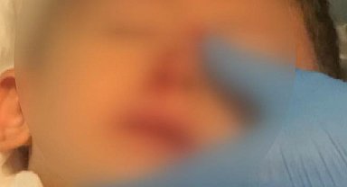 İstanbul - Eyüpsultan'da kreşteki çocuk 2 metre yükseklikten inşaat alanına düştü