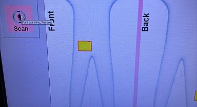 İstanbul- İstanbul Havalimanı'nda 3 kadının cinsel organlarında 6 kilo altın ele geçirildi