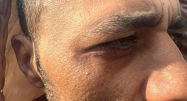 İstanbul - Taksim'de 'Borcunu sileceğiz' yalanıyla alıkonulup darbedildi: 'Şikayetini çek aileni öldürürüz' tehdidi