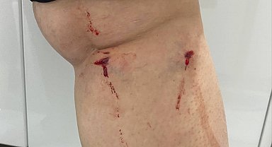 İstanbul - Üniversite kampüsünde köpeklerin saldırına uğradı: O anlar kamerada