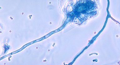 Ölümcül mantar hastalığı, küresel ısınmayla yayılabilir