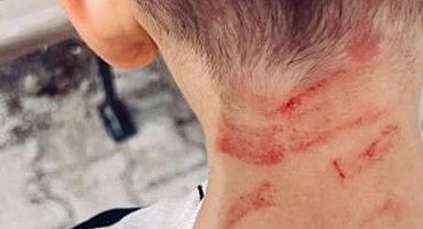 Rehabilitasyon merkezinde 5 yaşında çocuğa darp iddiasına soruşturma