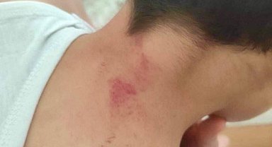 Şanlıurfa'da öğrencisini döven öğretmen tutuklandı