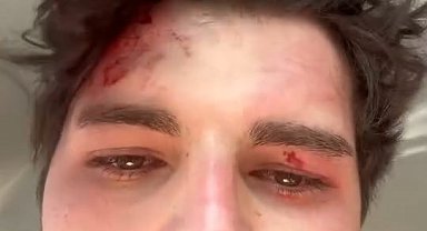 4 kişinin trafikte darbettiği oyuncu: Öldürene kadar döveceklerdi