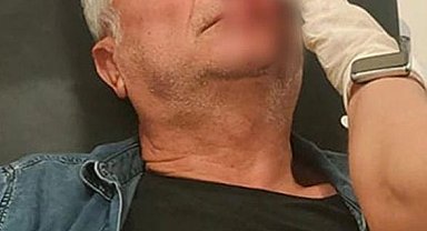 Adana'da muhtarı darbeden 3 kişi tutuklandı