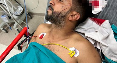 Döner yerken başına kurşun isabet etti