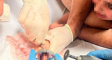 Parmağını musluk aynasına sıkıştıran 5 yaşındaki çocuğu itfaiye kurtardı