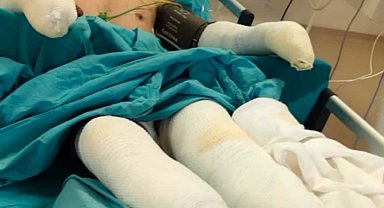 Orman yangınına müdahale sırasında ağır yaralanan eşinin son halini paylaştı