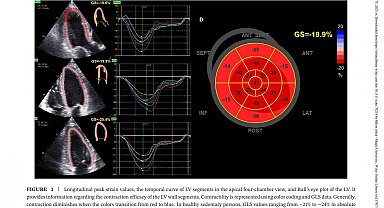 Ragbinin kadınların kalbini değiştirdiğini ortaya koyan çalışma ödüle aday