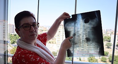 22 yıldır karnında ameliyat iğnesiyle yaşıyor