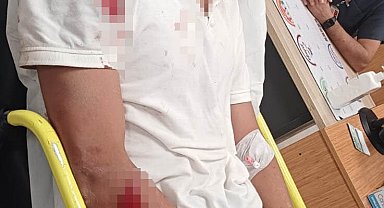 Ankara'da 14 yaşındaki Kenan Efe 'ne bakıyorsun' kavgasında hastanelik oldu