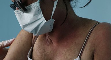 İnternetten sipariş verdiği krem hastanelik etti