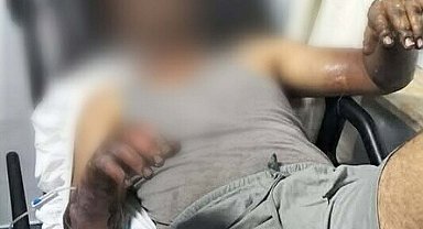 Oto tamirhanesinde patlama; 2 işçi yaralandı