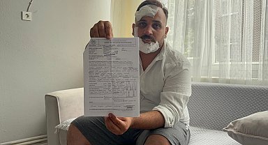 Taksici, eski sözlüsü ve ikizinin polis sevgililerinin kendisini dövdüğünü iddia etti