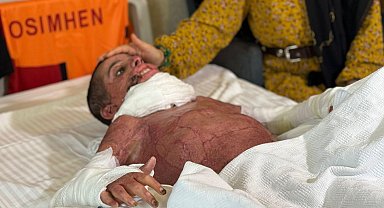 Vücudunun yüzde 50'si yanan Mustafa, yapay deri nakliyle hayata tutundu