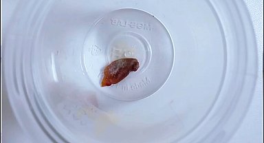 1,5 yıllık öksürüğün nedeni, kabak çekirdeği çıktı