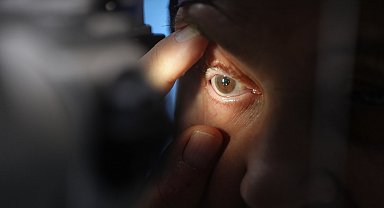 Görme kaybı yaşayan hasta, tedaviyle sağlığına kavuştu