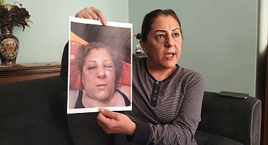 Kedi besleme kavgasında komşusunun burnunu kırdı; o anlar kamerada