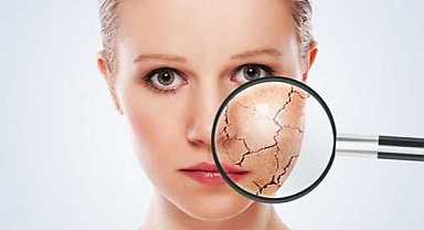 Cildiniz için kışa hazırlık reçetesi