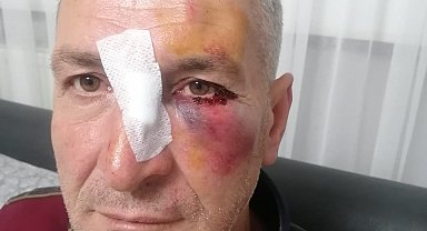 Dairesinin önüne hayvan dışkısı atan komşusundan, bu kez 'yüzüne kapı çarptığı' için şikayetçi oldu