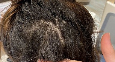 İstanbul- 'Kanser hastası çocuklara bağış' diyerek saçını kesen kuaförden şikayetçi oldu