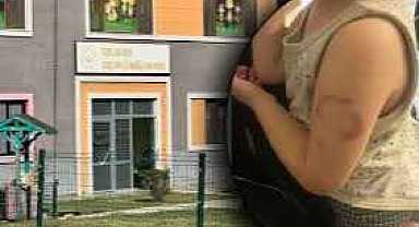 Öğretmen, 3 yaşındaki çocuğu ısırdı