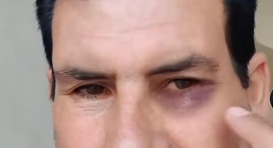 Rojin Kabaiş'e hakaretten tutuklandı