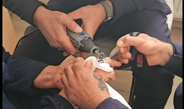 Parmağına sıkışan yüzüğü itfaiye çıkardı