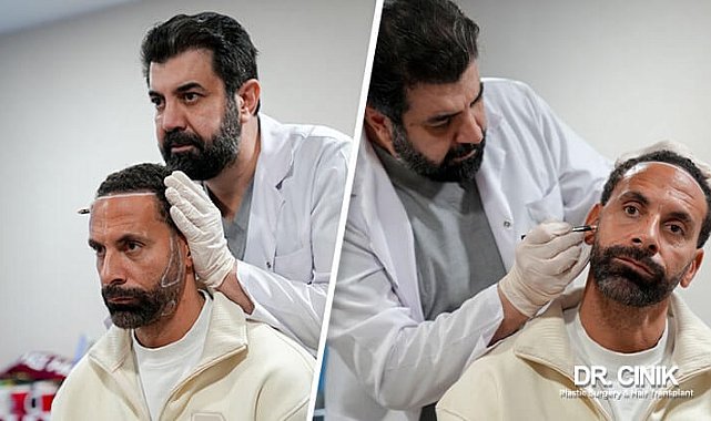 Dr. Cinik: Dünya yıldızı futbolcular saç ekimi için bizi tercih ediyor