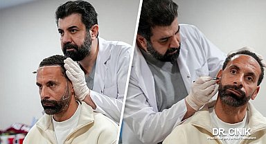 Dr. Cinik: Dünya yıldızı futbolcular saç ekimi için bizi tercih ediyor