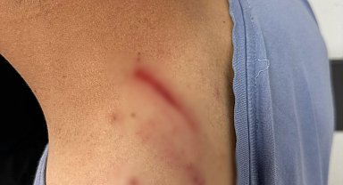 İlaç raporu tartışmasında tıbbi sekreteri darbetti