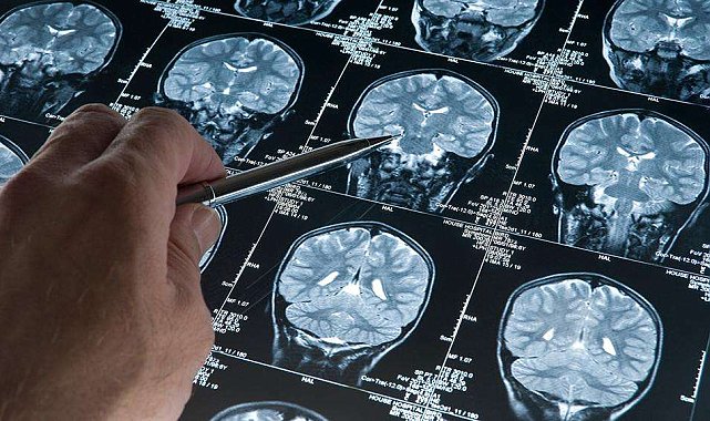 Araştırma: Derin uyku Alzheimer'ı yavaşlatıyor