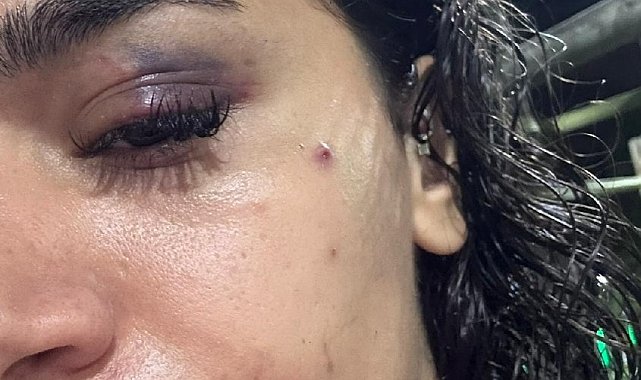 Bahçeşehir'de uzaklaştırma kararına rağmen evinin önünde darbedilen Ebru: Ölmeden önce sesimi duyun