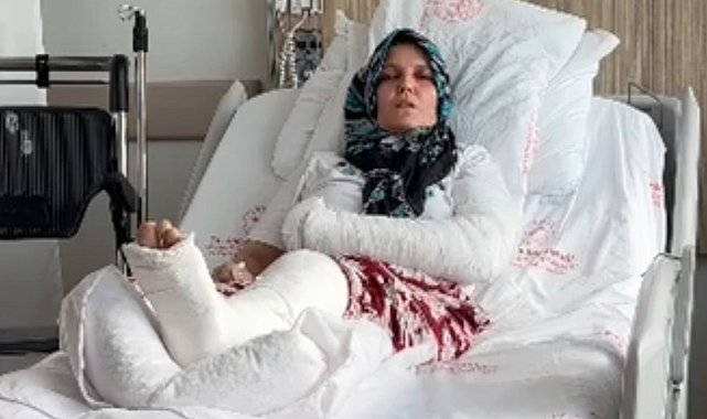 Kavgada 3 çocuk annesinin kolu ve bacağı kırıldı