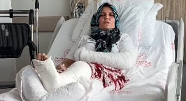 Kavgada 3 çocuk annesinin kolu ve bacağı kırıldı